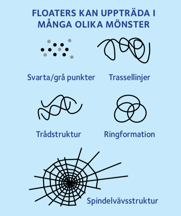Glaskroppsavlossning